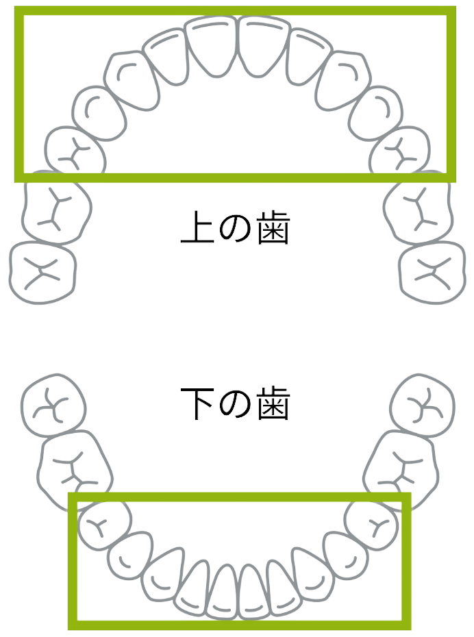 歯並びのイラスト