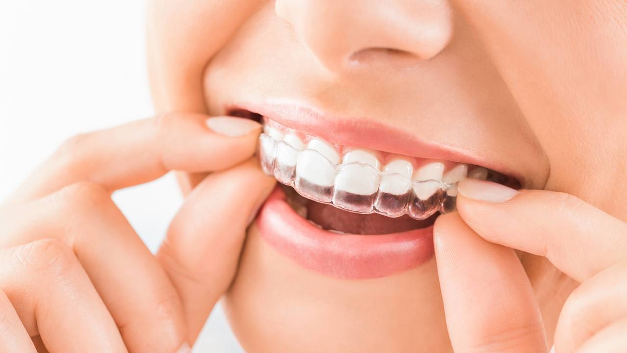 マウスピースを外す女性